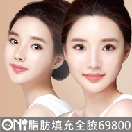 全臉補脂69800
